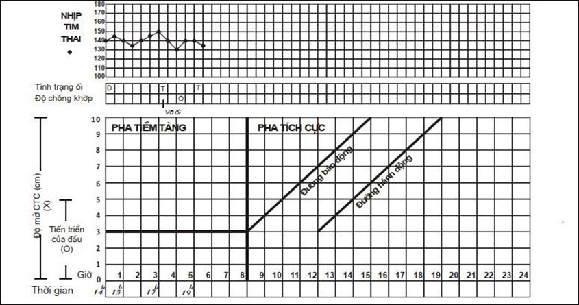Biểu Đồ Chuyển Dạ Là Gì? Cách Theo Dõi Chuyển Dạ Qua Biểu Đồ Chuyển Dạ